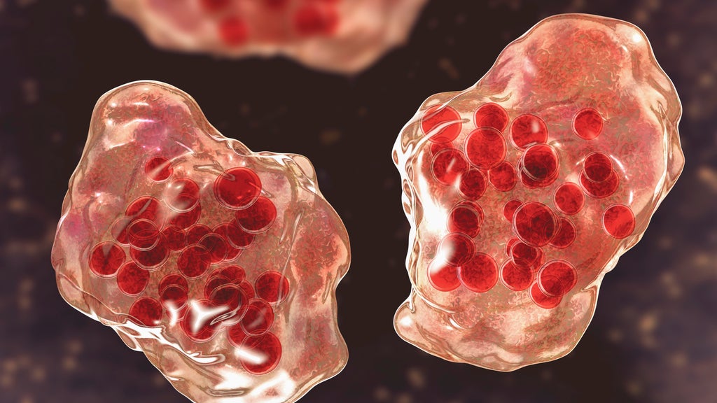 Central Minnesota county reports "several cases of suspected measles" — WCCO / CBS Minnesota, Crystal Health news